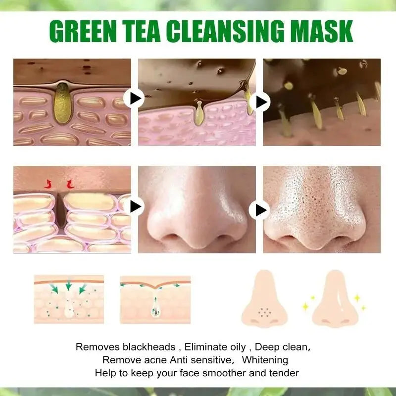 Original Green Tea Facial Blackhead Remover – Solid Mask for Acne, Blemishes, and Pore Shrinking Skin Care